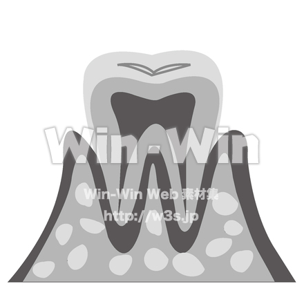 歯の断面図のシルエット素材 W-024091
